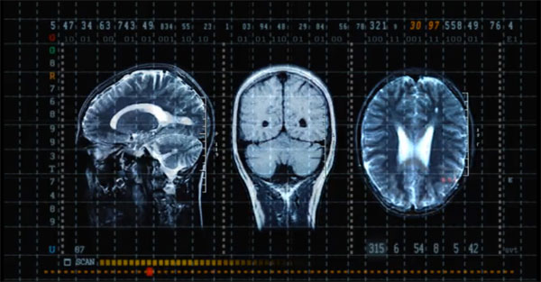 Brain-scan-static-fascinate-personality-test